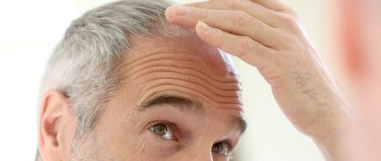 Analysis Follicum: Countdown to new hair loss trials