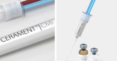 Analys, Bonesupport: Stöd för tillväxtutsikter