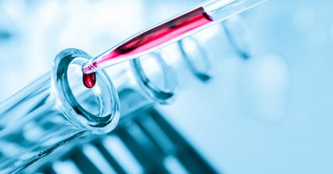 Analys, Nuevolution: Ett licensavtal av rang